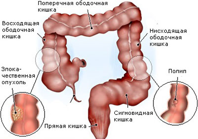 Специальные упражнения для позвоночника на фитболе