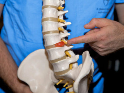 Причины заболевания и лечение протрузий дисков l3 l4 l4 l5 s1 пояснично-крестцового отдела позвоночника