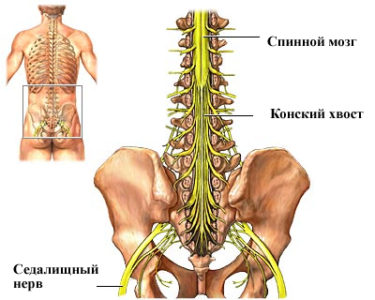 Симптомы заболевания и лечение синдрома конского хвоста
