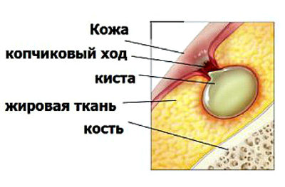 Изображение 6 Изображение 6