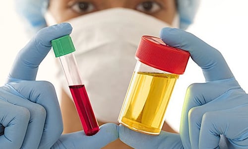 Перед оперативным вмешательством обязательно проводится обследование на общий анализ крови и мочи