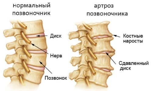 Область применения МРТ Область применения МРТ