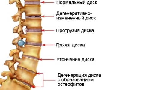 Что такое магнитно-резонансная томография? фото Что такое магнитно-резонансная томография? фото
