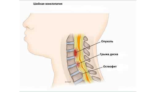 Общая информация о патологии Общая информация о патологии