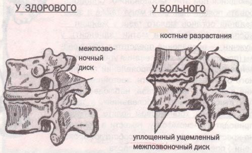 Причины возникновения заболевания