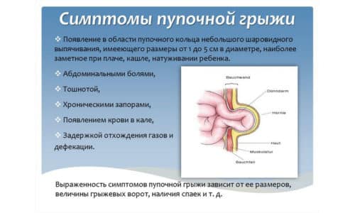 Сама по себе патология не беспокоит малыша, но сопутствует запорам и метеоризму, которые протекают болезненно, поэтому такие младенцы беспокойны и метеозависимы: при изменении погоды становятся вялыми, сонливыми или капризными