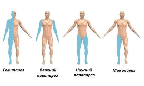Клинические проявления Клинические проявления